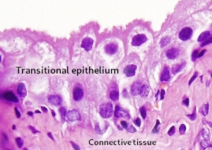 Transitional epithelium