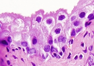 Transitional epithelium