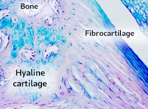 Fibrocartilage