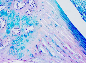 Fibrocartilage