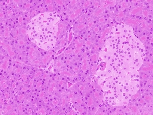 Pancreas