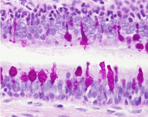 Intraepithelial gland