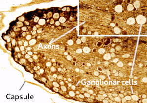 Ganglion