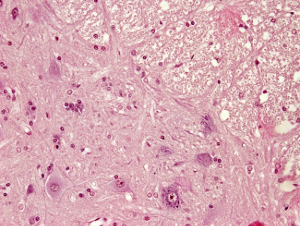 Nervous tissue