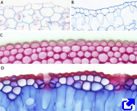 Tipos de epidermis