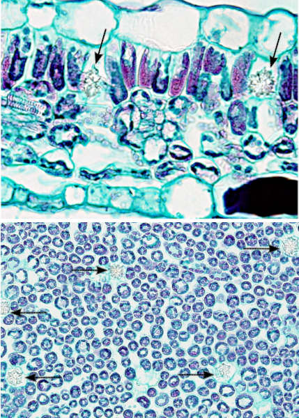 Tricomas