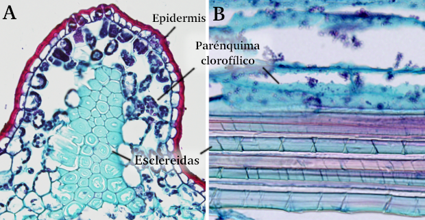 Esclerénquima