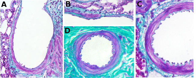 Arteriole