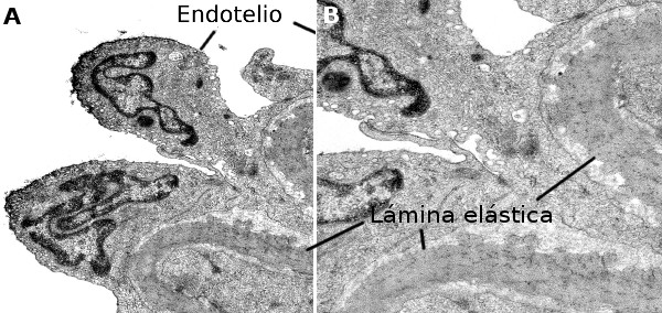 Endotelio de arteriola