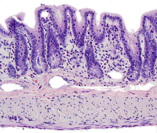 Intestino grueso