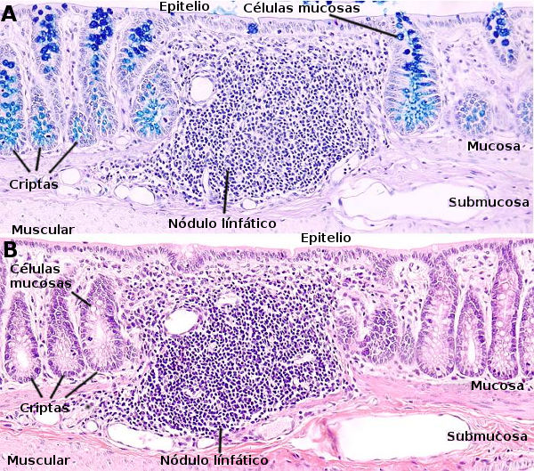 Intestino grueso