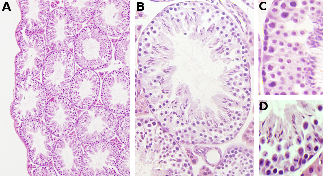 Seminiferous tubules