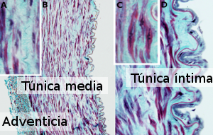 Arteria elástica