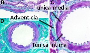 Arteriola