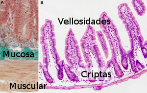 Intestino delgado