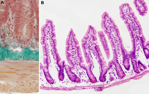 Intestino delgado