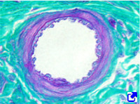 Arteriole