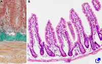 Intestino delgado