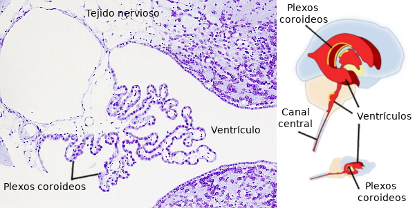 Plexos coroideos