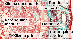 Tallo secundario de Gimnosperma