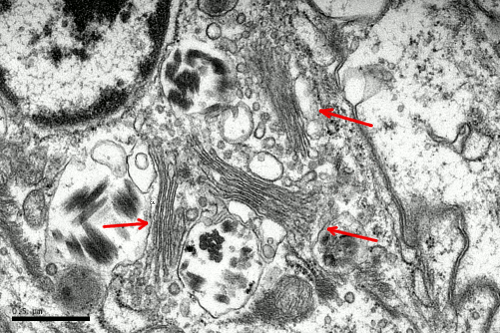  Aparato de Golgi