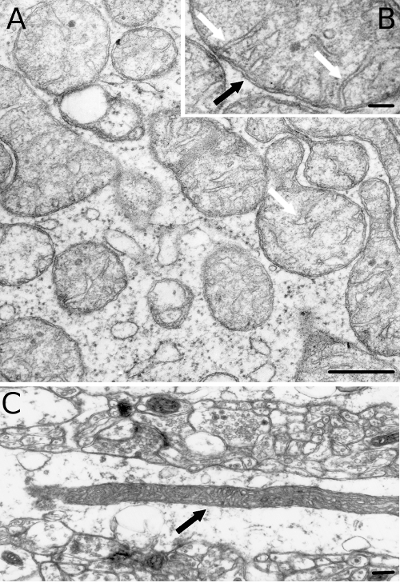  Mitocondria