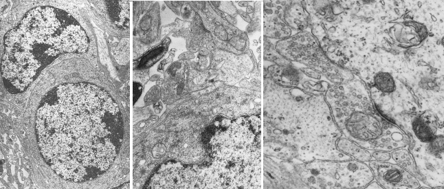 Imagenes de microscopía electrónica