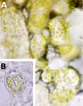  Chloroplasts