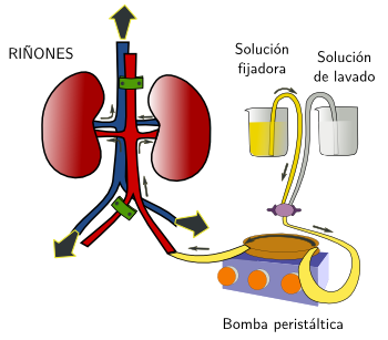 Perfusión