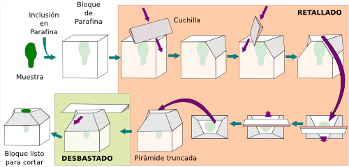 Preparación del bloque de parafina