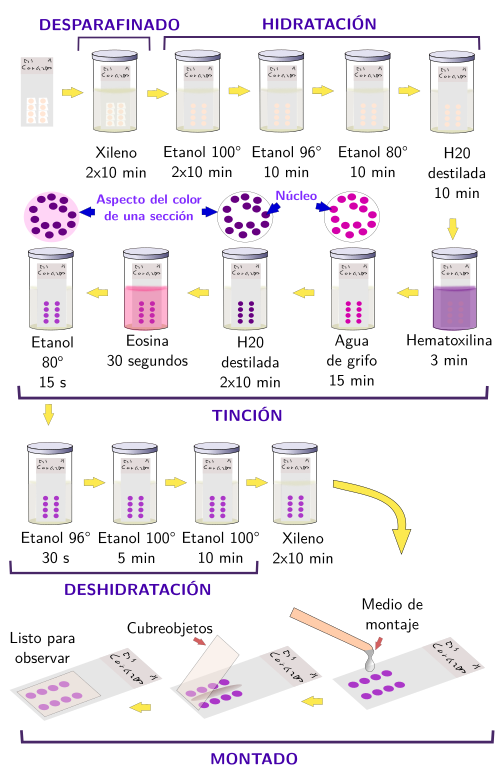 Tinción con hematoxilina-eosina