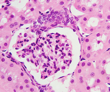 Riñón teñido con hetamoxilina-eosina