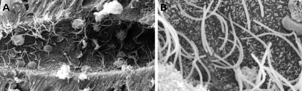 Imágenes de microscopio electrónico de barrido