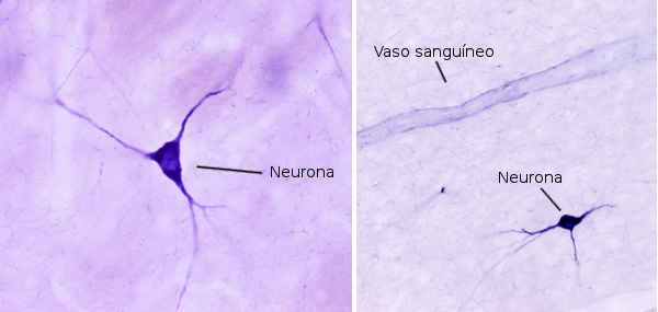 Corteza dorsal