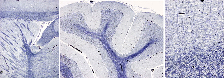 Woelcke staining