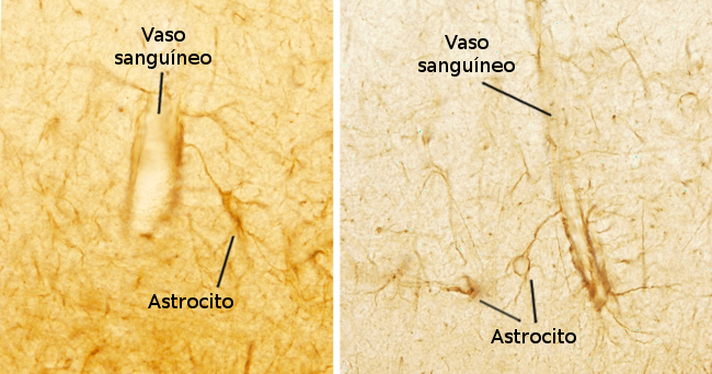 Astrocitos