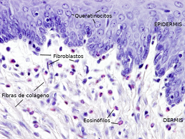 Fibroblastos