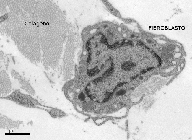 Fibroblastos