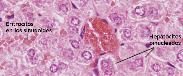 Hepatocitos