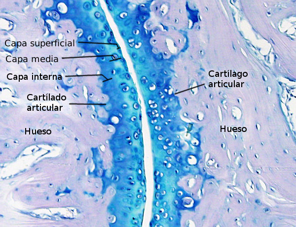 Cartílago articular