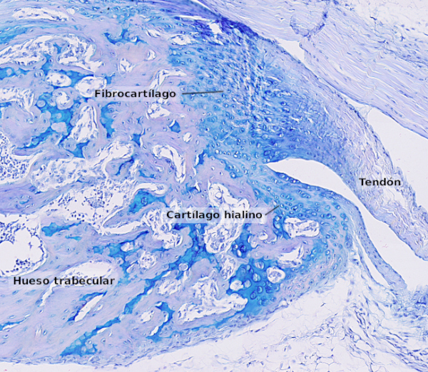 Fibrocartílago