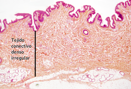 Fibroblastos