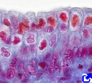 epitelio estratificado prismático