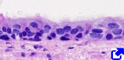 Pseudostratified epithelium