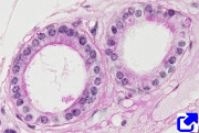 Simple cuboidal epithelium