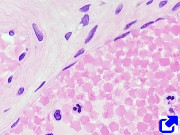 Simple squamous epithelium