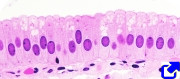 Simple columnar epithelium