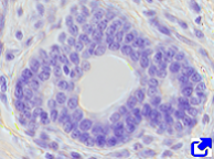 Simple strsatified epithelium