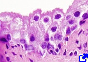 Transitional epithelium