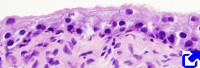 Transitional epithelium